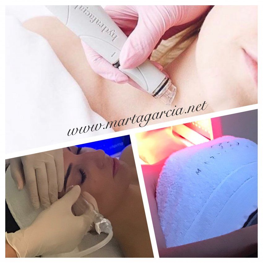 hydrafacial 2 web