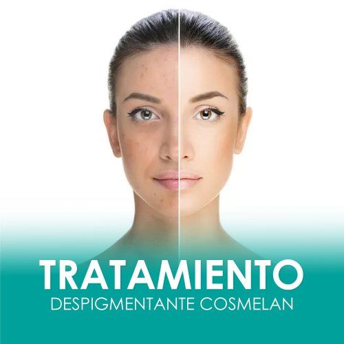 cosmelan