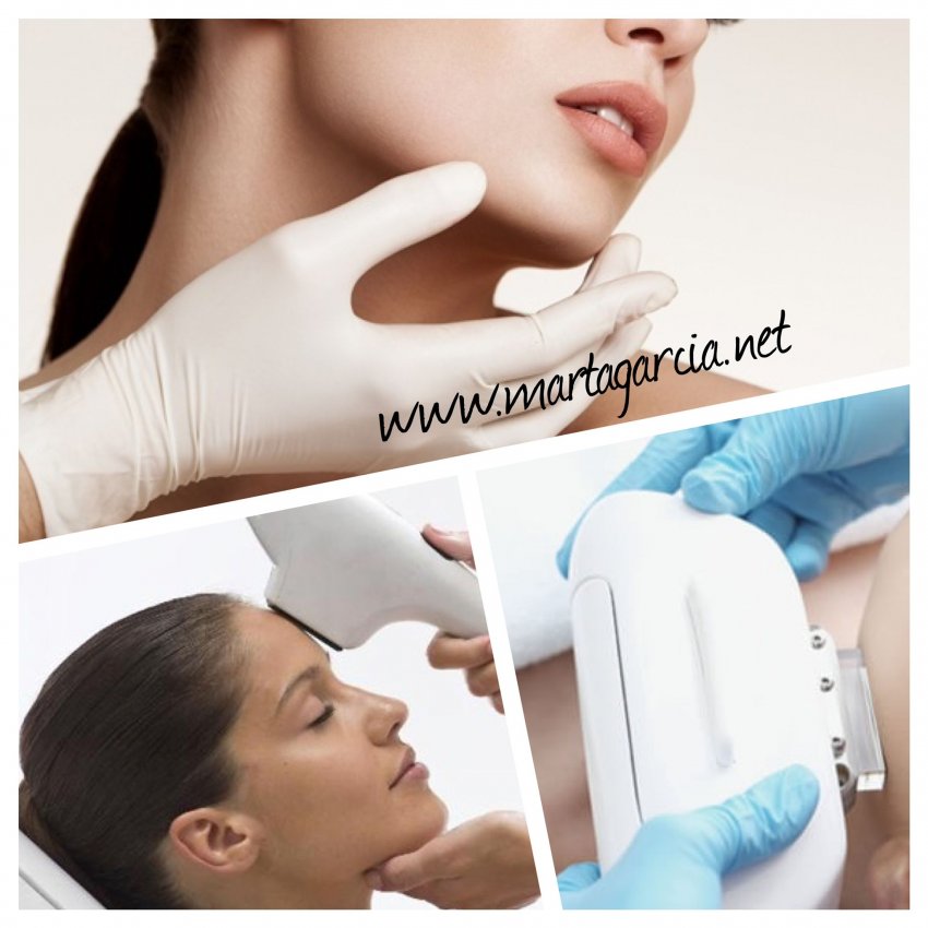 ipl luz pulsada facial